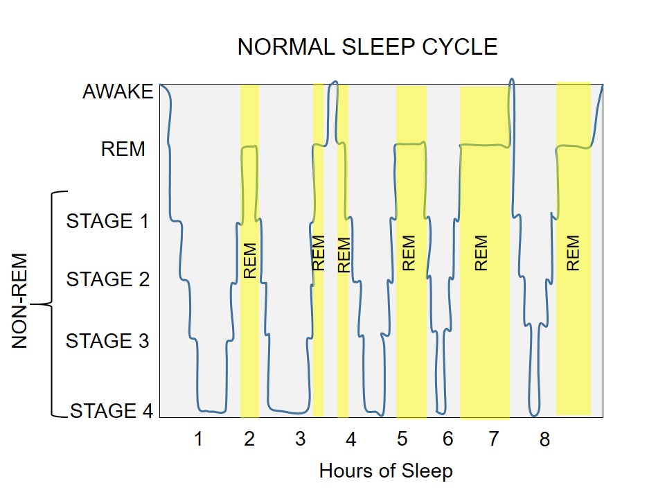 8 Ways to Prevent Sleep Deprivation from Killing Your Brain – Musings ...