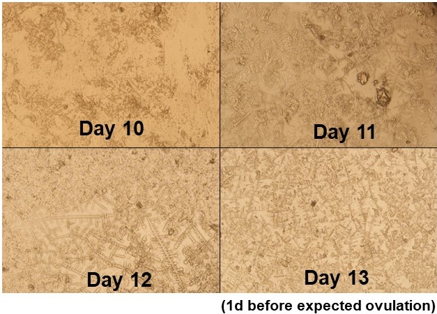 A picture of the saliva ferning pattern. This saliva test can help a woman get pregnant. 