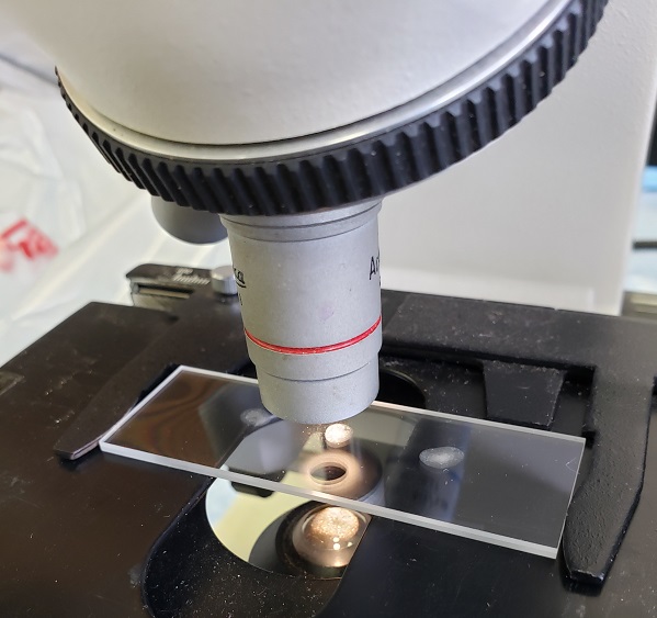 Picture of microscope reading a saliva spot during saliva test. This is a good test to help a woman get pregnant. 