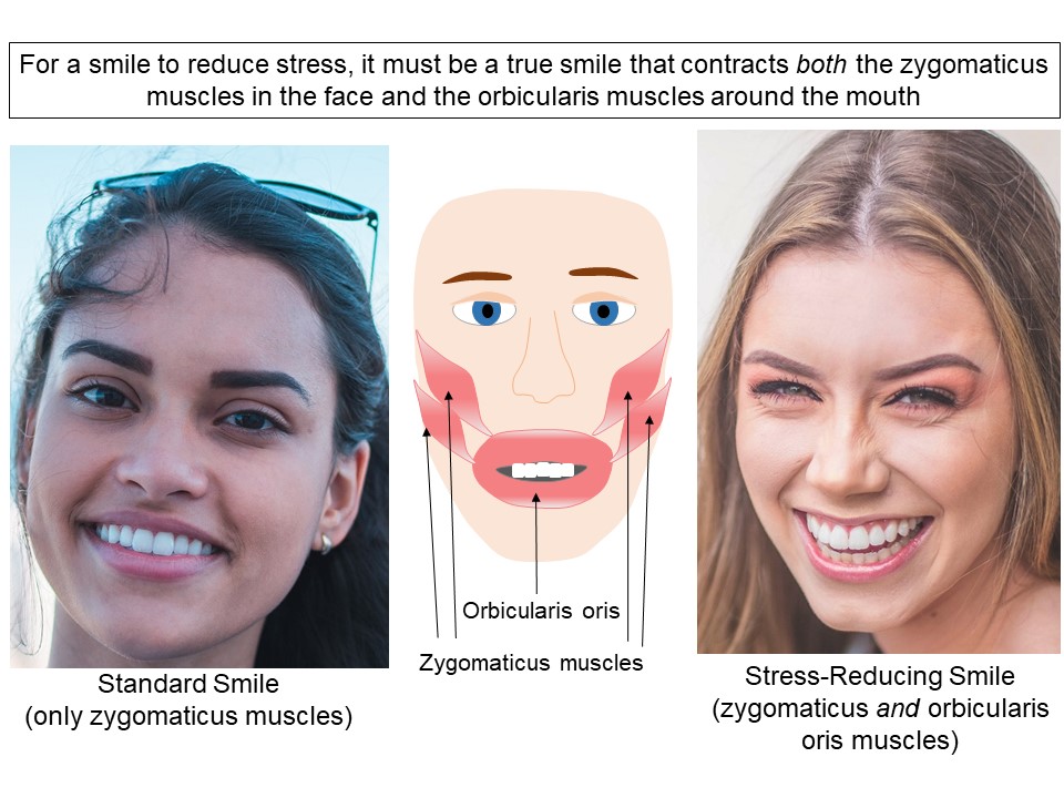 Picture of smile types. A standard smile only utilizes the zygomaticus muscles, but a full smile uses the zygomaticus and the orbicularis oris muscles. 